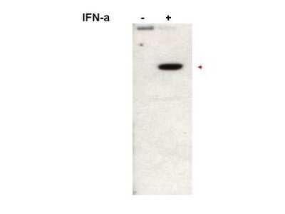 Western Blot: STAT2 [p Tyr690] Antibody [NB110-86975]